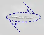leg1