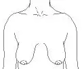Droopy breasts