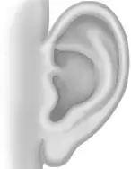 Otoplasty 1