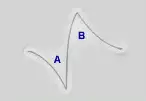 Z-plasty changes direction and tension in a scar