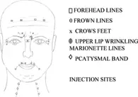 botox